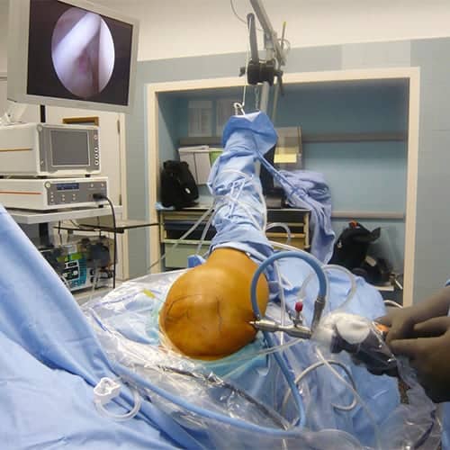 operation epaule luxation specialiste articulation epaule clinique jouvenet epaule chirurgien orthopediste specialistes epaule